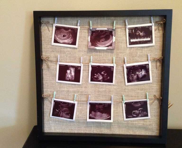 Frame your ultrasound pictures